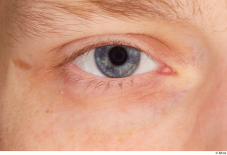 Stanley Johnson eye 0001.jpg